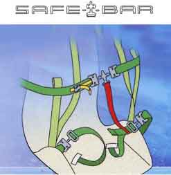 Safe-T-Bar